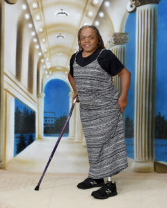 Sandra, a medium brown skinned woman, is wearing a spaghetti strap black and white dress with a black shirt underneath it. She is smiling and stands with a cane, and her prosthetic left leg is visible.